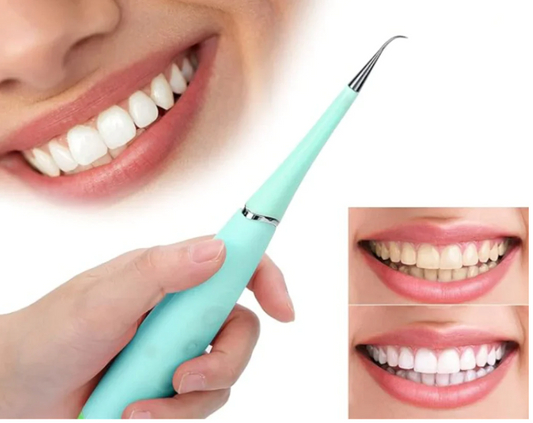 SmilePro™: Removedor de Sarro Dental Magnético