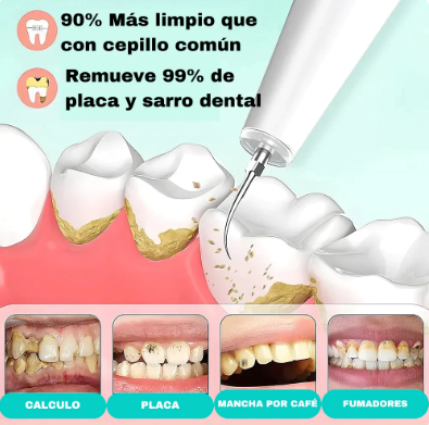 Removedor de Sarro Dental Magnético®